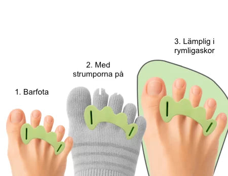 ORTOPEDISK TÅSEPARERARE